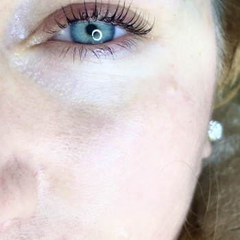 Лора Кирнична, Чернівці Фото - 5