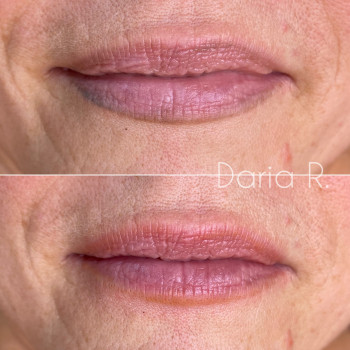 Дарья , Київ Фото - 8