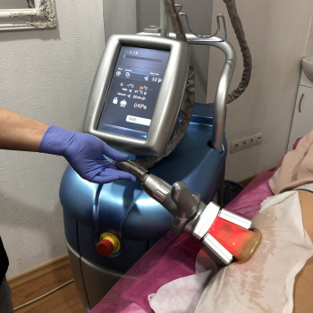 Криолиполиз LipoFREEZE Италия
                    Косметологический центр SlimBar Харьков