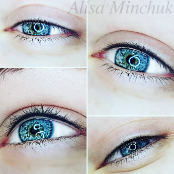 Межресничка