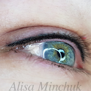 Межресничка