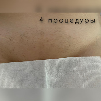 Мария Малиновская, Днепр Фото - 5