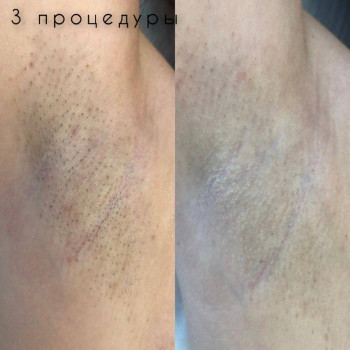 Мария Малиновская, Днепр Фото - 6