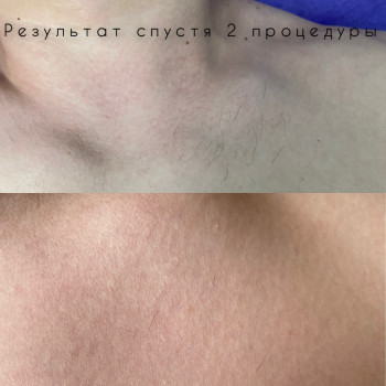 Мария Малиновская, Днепр Фото - 9