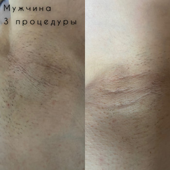 Мария Малиновская, Днепр Фото - 11