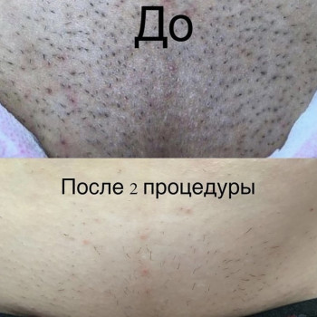 Мария Малиновская, Днепр Фото - 12