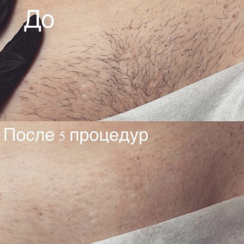 Мария Малиновская, Днепр Фото - 13