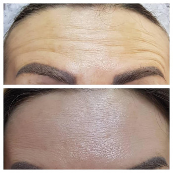 Класика, Хуст Фото - 5