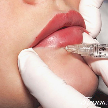 Омолаживание губ