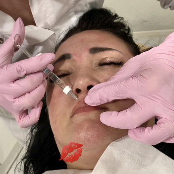 Контурна пластика