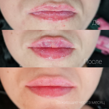 Ірина Павленко, Чернівці Фото - 59