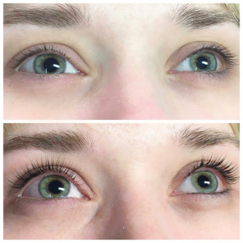 Ламинирование