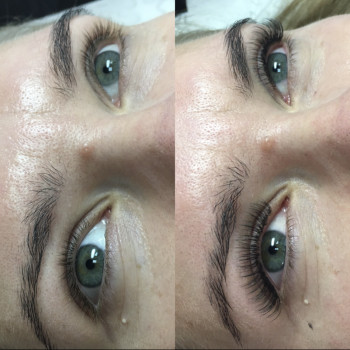 Классическое наращивание