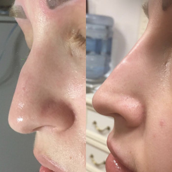 Жанві, Львів Фото - 32