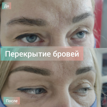 Перекрытие татуажа