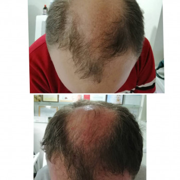 Mon Amour, Запорожье Фото - 4