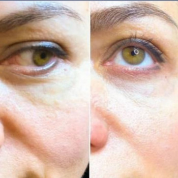 Mon Amour, Запорожье Фото - 3