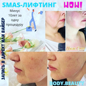 Сергій Савін, Запоріжжя Фото - 41