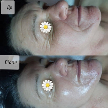 Ольга Било, Бучач Фото - 5