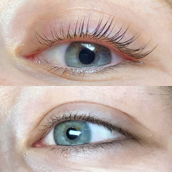 Ламі вій + ботокс