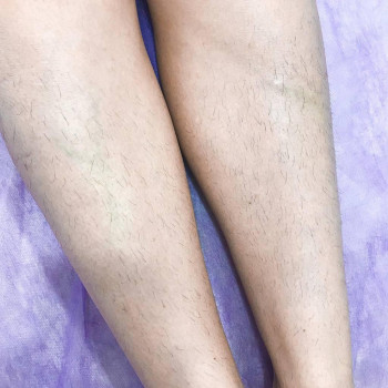 Инна Митиогло, Никополь Фото - 6