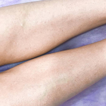 Инна Митиогло, Никополь Фото - 7