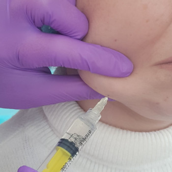 Убираем второй подбородок