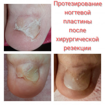 Олена Коваль, Киев Фото - 43