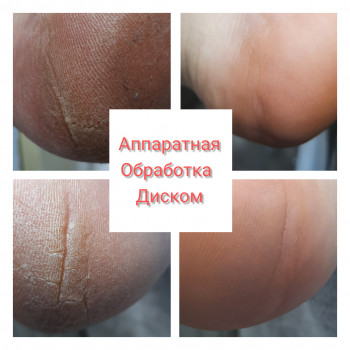 Олена Коваль, Киев Фото - 44