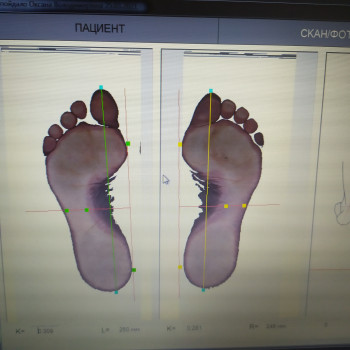 Діагностика стопи