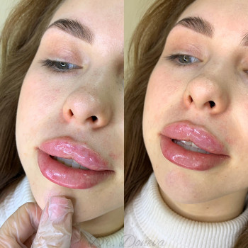 Фото из портфолио косметолога Елена Helen (Одесса)