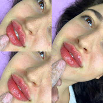 Фото из портфолио косметолога Елена Helen (Одесса)