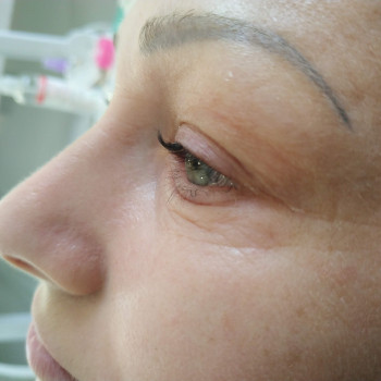 Лами ресничек