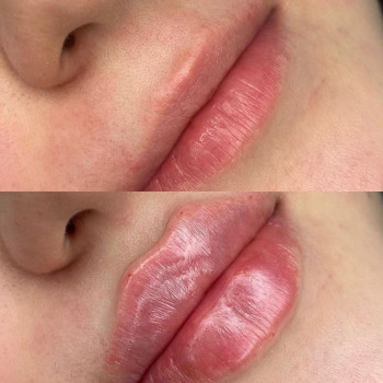 Юлия Верховод, Полтава Фото - 50