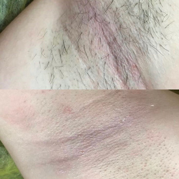 Депиляция
                    Массажист Евгения Одесса