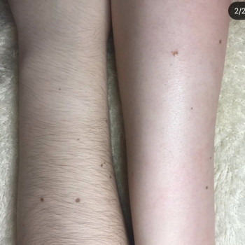 Депиляция
                    Массажист Евгения Одесса