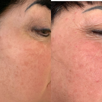 Анна , Черкассы Фото - 5