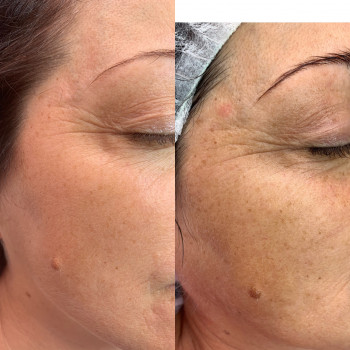 Анна , Черкассы Фото - 6