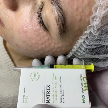 Анна , Черкассы Фото - 8