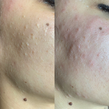 Анна , Черкассы Фото - 9