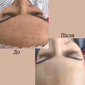 Галина Сенюк, Волочиск Фото - 5