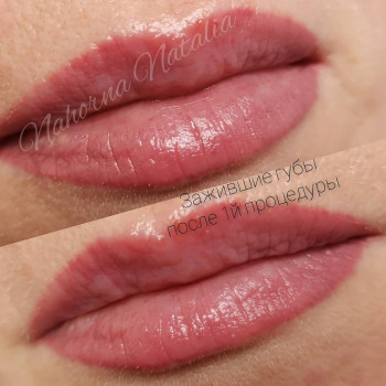 Зажившие губы спустя месяц
