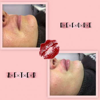 Вєра Бацула, Гайсин Фото - 5