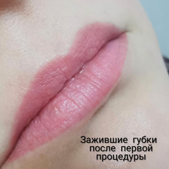 Зажившие, одна процедура