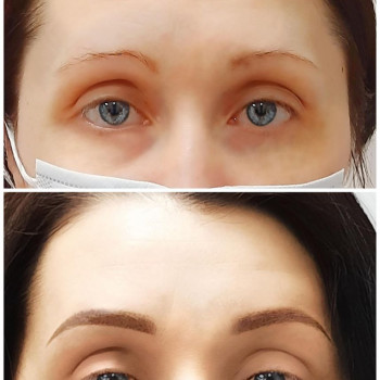 Анна Фишер, Київ Фото - 6