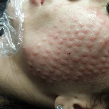 Елизавета Сайко, Запорожье Фото - 5