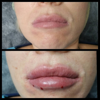 Елизавета Сайко, Запорожье Фото - 9