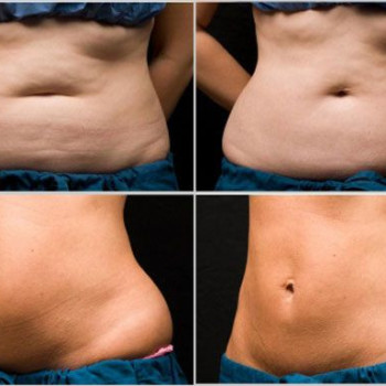 Оксана Білик, Львов Фото - 5