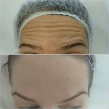 Фото с портфолио Dr. Gomon Cosmetology