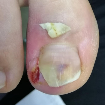 Олена Вертас, Львів Фото - 10